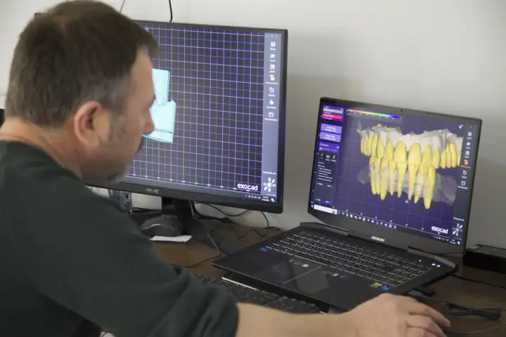 Exocad ile implant üstü restorasyon tasarımı — çift ekranlı CAD iş istasyonu